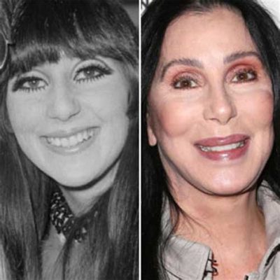 Who is Cher's Plastic Surgeon and Why Do We Care So Much About Celebrity Transformations?